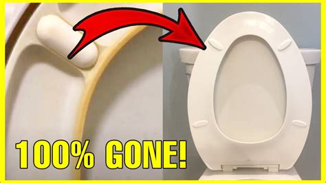 Can Candida spread from toilet seats?