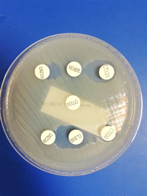 Can E. coli produce AmpC?