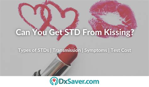 Can French kissing transmit STD?