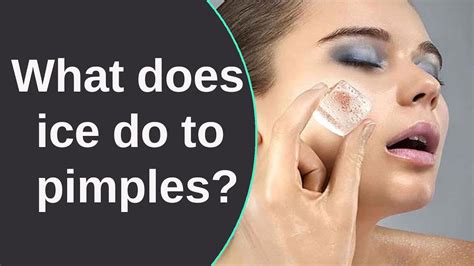 Can I apply direct ice on pimples?