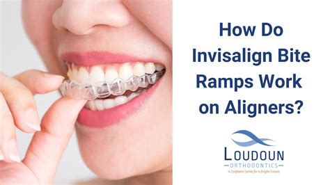 Can I bite on my aligners?