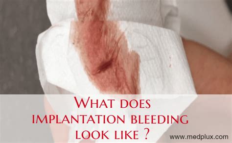 Can I bleed and still be pregnant?