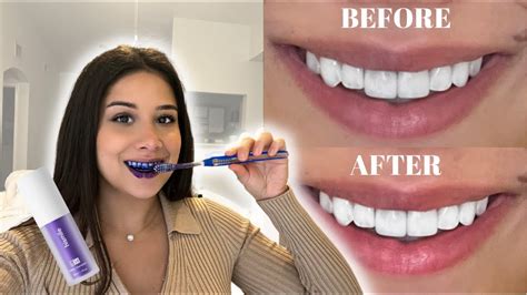 Can I brush my teeth after using Hismile?