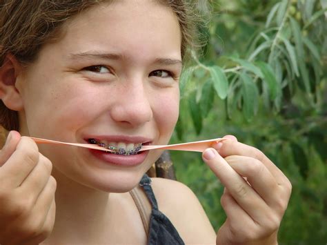 Can I chew gum with braces?