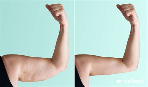 Can I fix flabby arms over 50?
