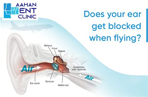 Can I fly with blocked Eustachian tube?