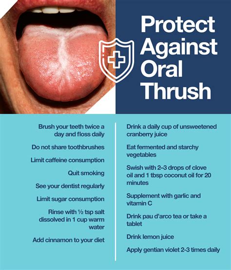 Can I give oral thrush to my partner?