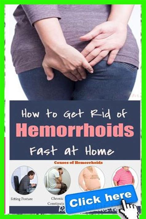 Can I ignore hemorrhoids?