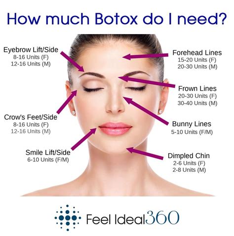 Can I just do Botox once a year?