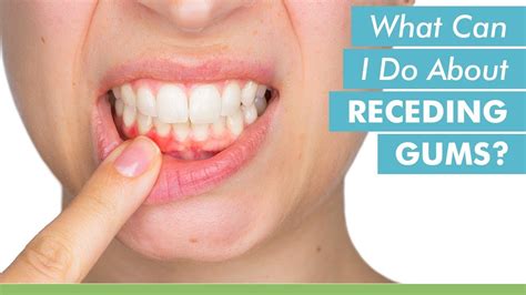 Can I massage my gums with my fingers?