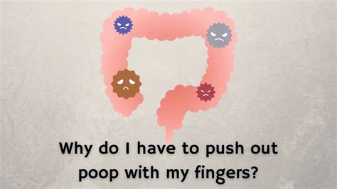 Can I push to poop with hemorrhoids?