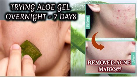 Can I put aloe vera on my face every morning?