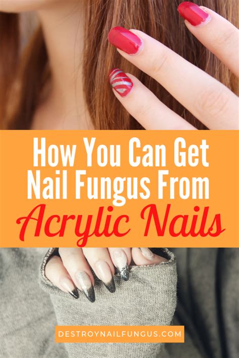 Can I put fake nails over fungus?