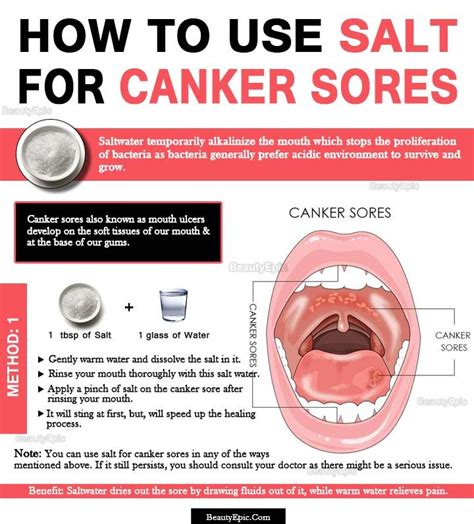 Can I put salt on a cold sore?