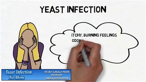 Can I sleep with my husband if I have yeast infection?