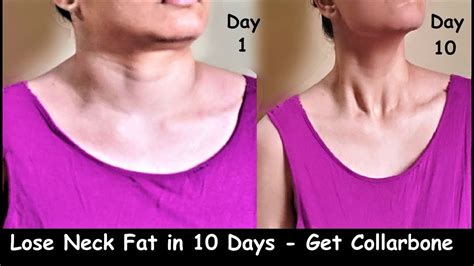 Can I slim down my neck?