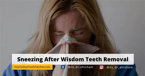 Can I sneeze after wisdom teeth removal?