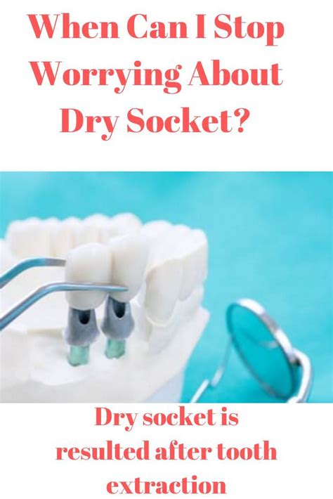 Can I stop worrying about dry socket after 5 days?