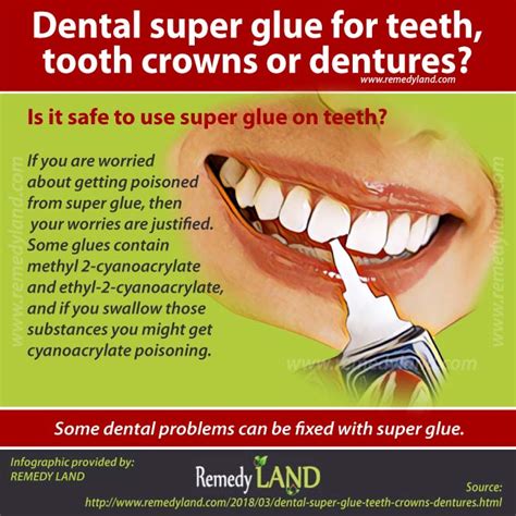 Can I super glue a tooth?