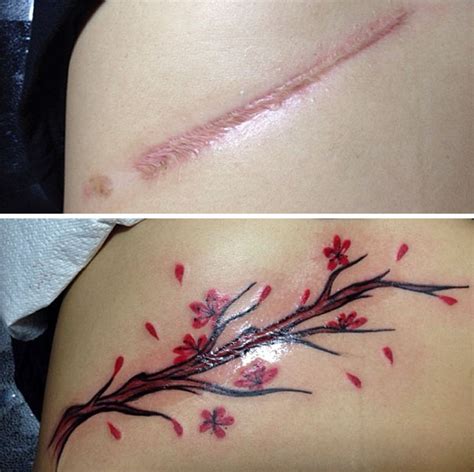 Can I tattoo a scar?