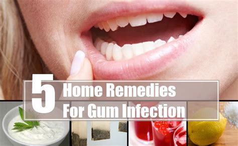 Can I treat a gum infection at home?
