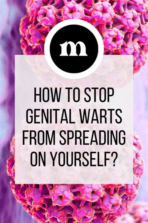 Can I treat genital warts myself?