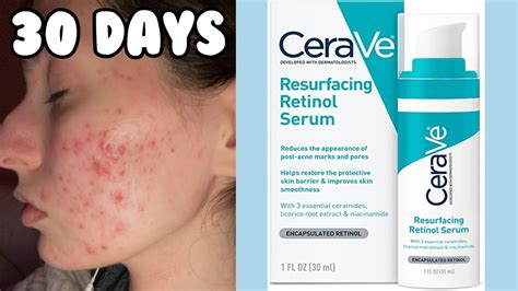 Can I use Cerave for chest acne?
