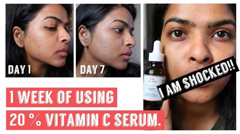 Can I use Vitamin C serum after Botox?