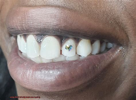 Can I use super glue for teeth gems?