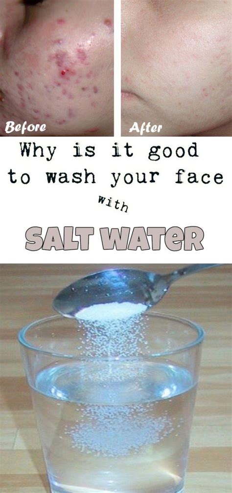 Can I wash my face with salt water everyday?