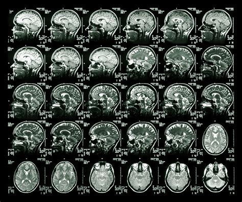 Can MRI read your thoughts?