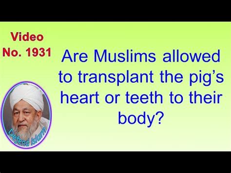 Can Muslims accept heart transplant?