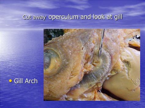 Can Operculum go away on its own?
