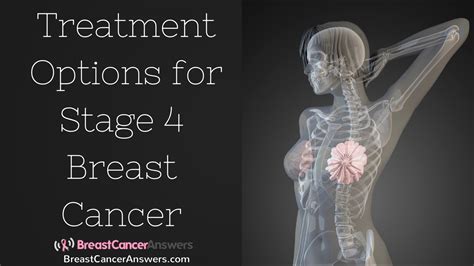 Can Stage 4 cancer shrink?