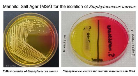 Can Staphylococcus survive in high salt conditions?