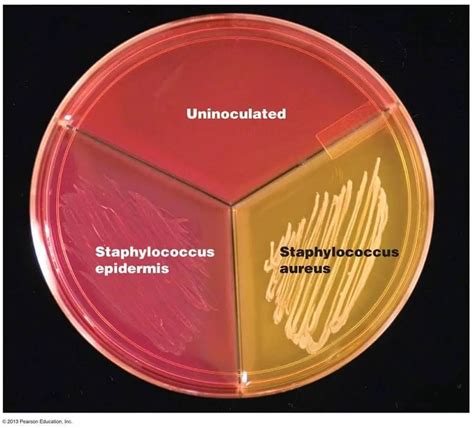 Can Streptococcus grow in salt?