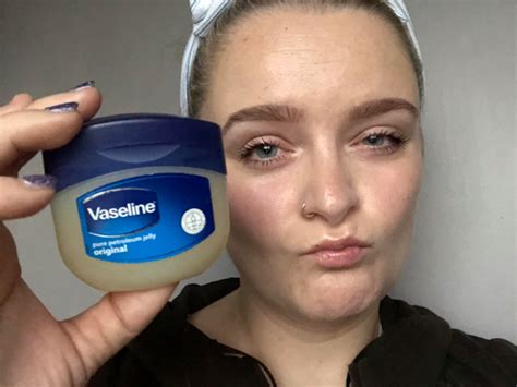 Can Vaseline cause dark lips?