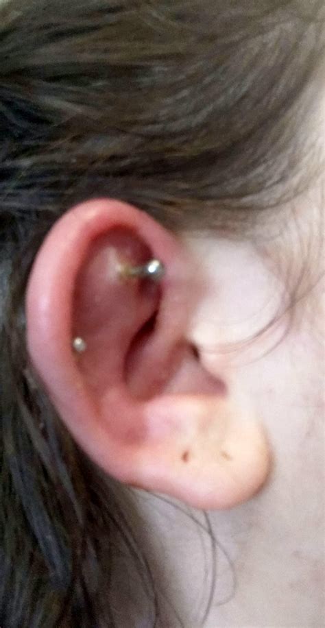 Can a 10 year old piercing get infected?