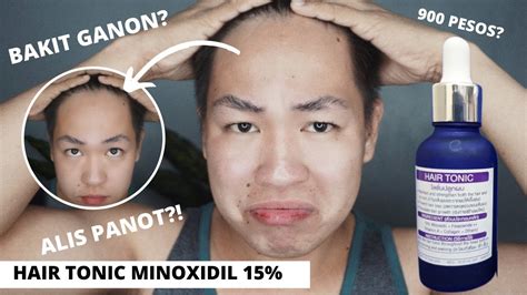 Can a 15 year old use minoxidil?