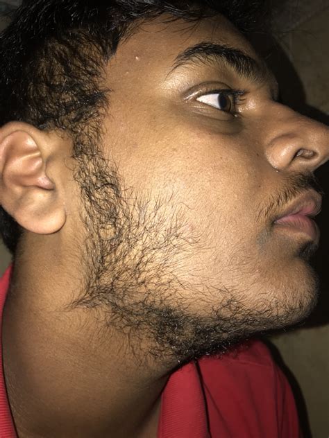 Can a 16 year old have a goatee?