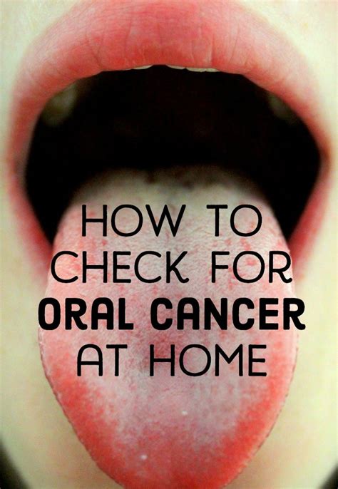 Can a 17 year old get tongue cancer?
