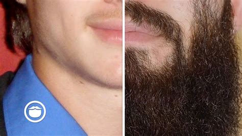 Can a 23 year old grow a full beard?