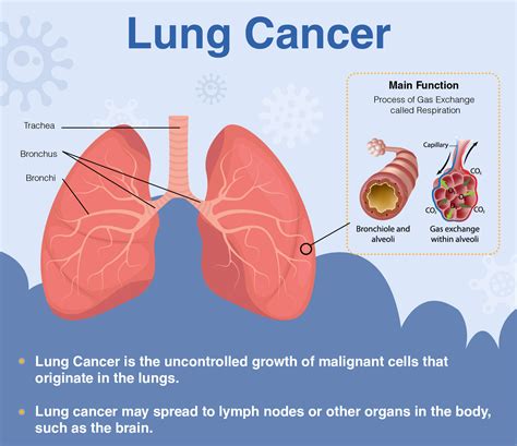 Can a 25 year old get lung cancer?