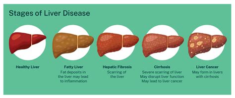 Can a 30 year old have cirrhosis?