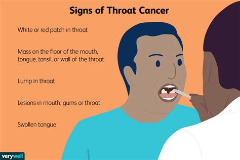 Can a 40 year old get throat cancer?