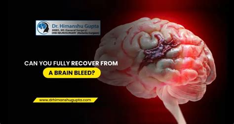 Can a 90 year old recover from a brain bleed?