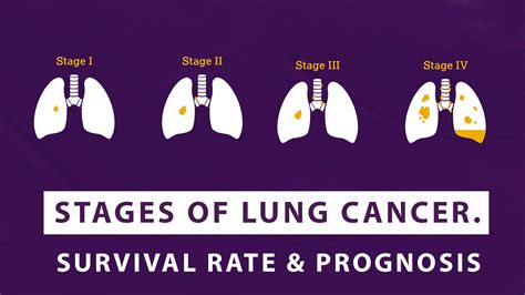 Can a 90 year old survive lung cancer?