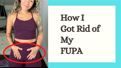 Can a FUPA go away naturally?