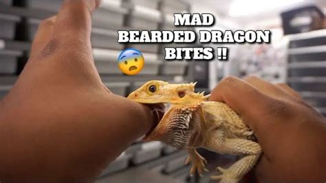 Can a bearded dragon bite off a finger?