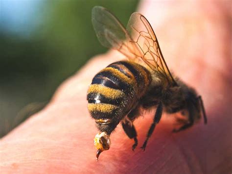 Can a bee sting get infected a week later?